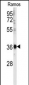 U2AF1 Antibody (Center Y114)